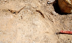 Two Druse Plates Found on Left Side Here